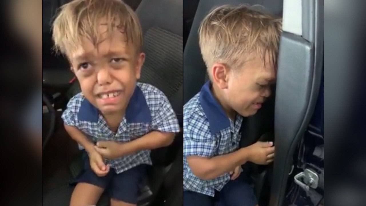 (Видео) Детето кое сакаше да се самоубие помина низ тешка операција