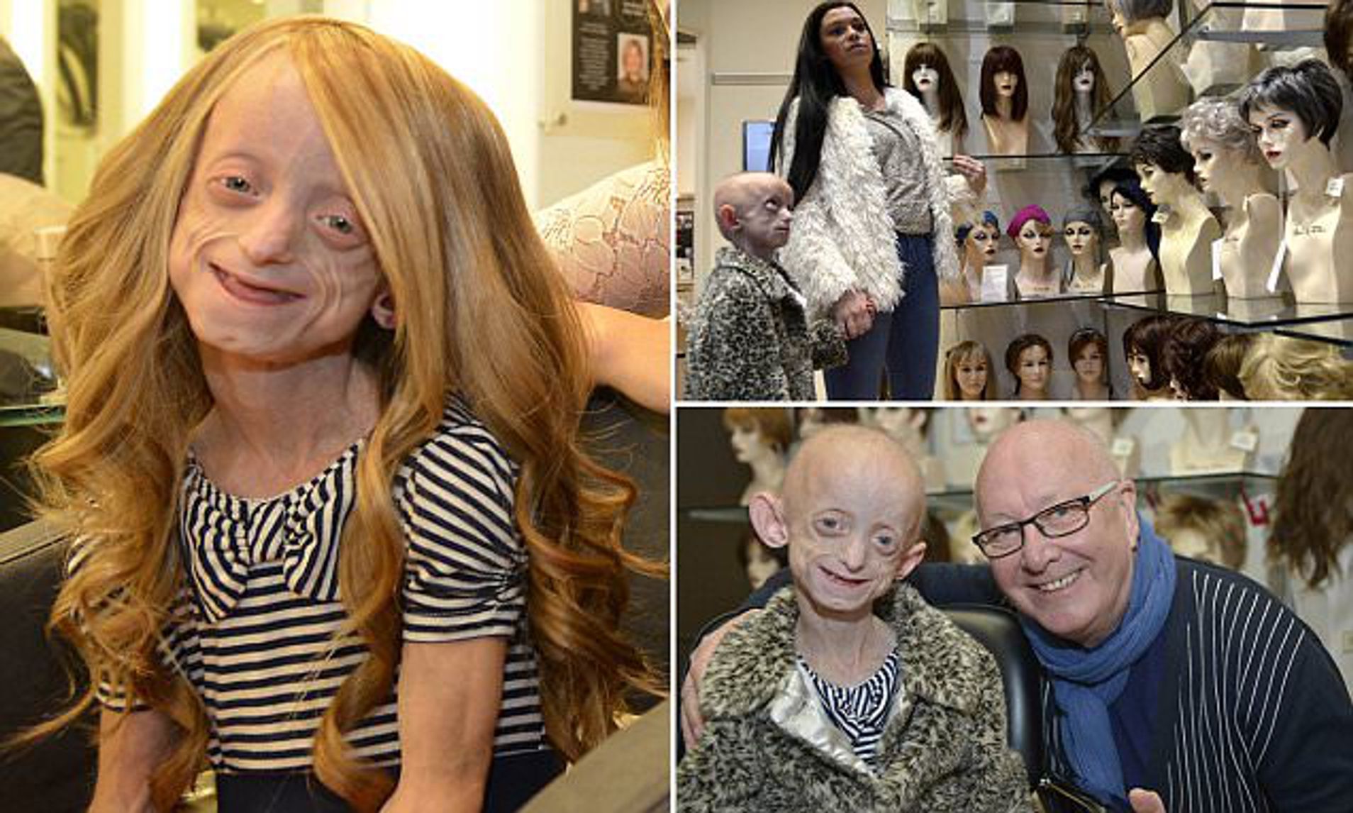 Почина Ашанти Смит, 18-годишна тинејџерка заробена во тело на 144-годишна старица