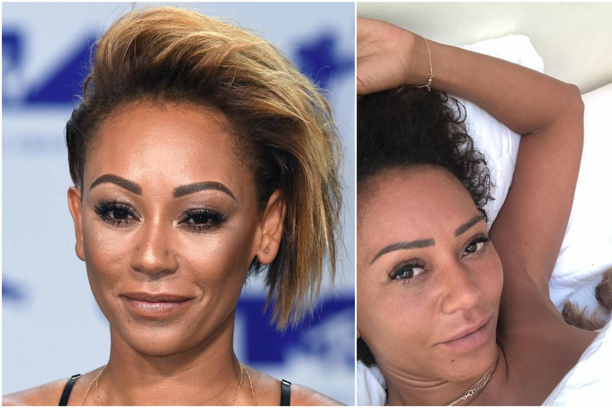 Луѓе, короната не е шега, рече поранешната спајсица Мелани, која петта недела се бори со опасниот вирус