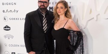 (Фото) Пластичните операции ѝ го уништија лицето на Лара Флин Бојл