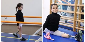 Шест годишната гимнастичарка Олександра ја загуби ногата во ракетен напад: сега повторно вежба со протеза
