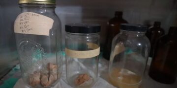 Истражувач во напуштена болница која служела за тестирање, во тегла пронашол изваден мозок