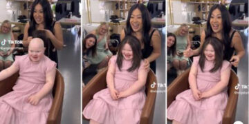 Искрена насмевка: девојче со Даунов синдром и алопеција се радува на новата перика