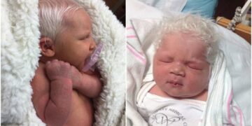 (Видео) Бебе родено со седа коса стана хит, докторите немаат објаснување за феноменот