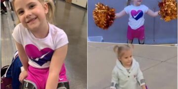 (Видео) Девојчето кое се роди со споени нозе ги направи првите чекори