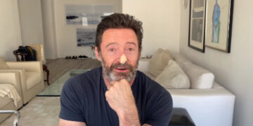 Глумецот Хју Џекмен повторно прави тестирање за рак на кожата, откако претходно шест пати му беше дијагностициран