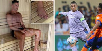 Роналдо ги лакира ноктите на нозете за да спречи габични инфекции