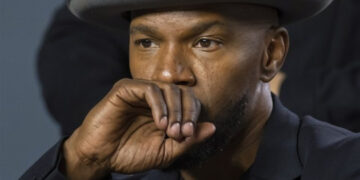 Џејми Фокс имал мозочен удар