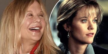 Мег Рајан има премногу ботокс, не може да прави гримаси, а очите и изгледаат помали