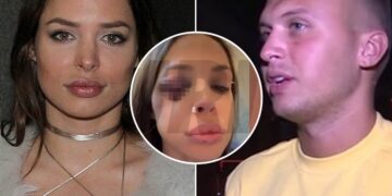 Српска старлета брутално претепана од поранешен учесник во „Задруга“