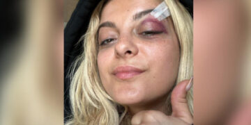 Се обидував да видам дали можам да ја погодам со телефонот, беше забавно, вели дечкото што ја повреди Бебе Реџа по глава