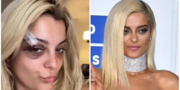 Фала богу немаше мобилни, Бебе Реџа два дена по инцидентот имаше нов концерт