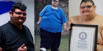 Поради тежината не можел да се движи, некогаш најдебелиот човек на светот ослабе 200 килограми