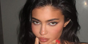 Кајли Џенер отворено за пластичните операции: Користев само филери, и жалам поради тоа