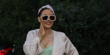 Ана Николиќ со модрици и рани на нозете позира во бутик, фановите на пејачката загрижени за нејзината состојба