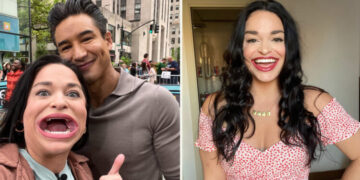 Американка е прогласена за девојка со најголема и најширока уста во светот