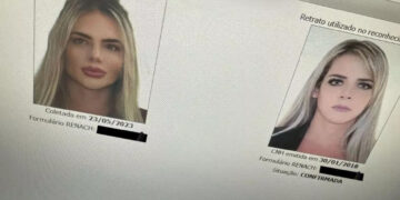 Модел на „Онли фанс“ потрошила 250.000 евра на операции: „Никој не ме препознава на личната карта“