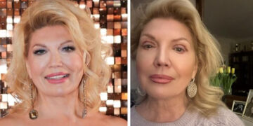 Најпознатата лото девојка на поранешна Југославија покажа како изгледа по естетската операција