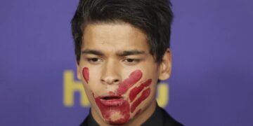 Црвен отпечаток од дланка на устата: што се крие зад потегот на актерот