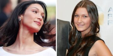 Прогласена е за една од најубавите жени на светот, ретко кој се сеќава како изгледаше пред операциите