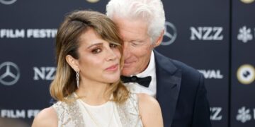 Прогласена е за една од најубавите жени на светот, ретко кој се сеќава како изгледаше пред операциите