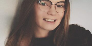 (Фото) Алана отиде во Турција да си ги среди забите и остана без нив: „Ми го уништија животот“