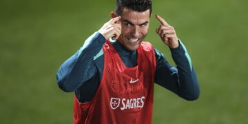 На Роналдо му се заканува тужба, не платил ботокс:  дерматологот бара отштета