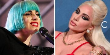 Лејди Гага негира дека имала естетска операција, експертите тврдат дека направила нешто