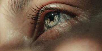 Темни кругови по празниците: 7 природни и брзи решенија за нивно отстранување