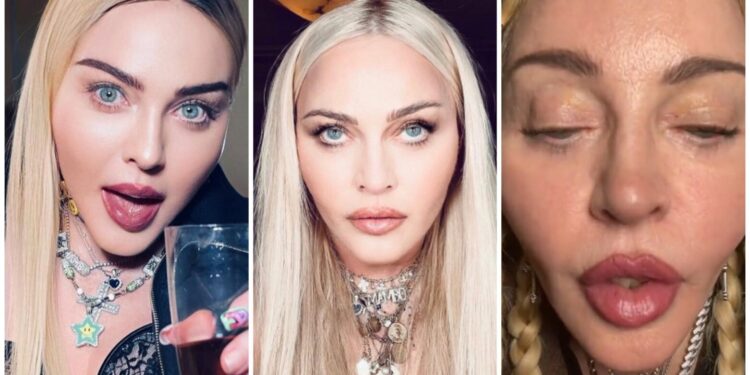 Мадона со нов изглед: „затегнатото“ лице предизвика бура реакции на интернет