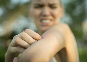 Комарците ги избегнуваат „како вампири“: Овие природни трикови навистина функционираат