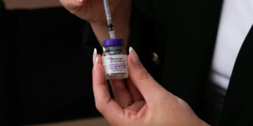 Ботоксот не ги брише само брчките: Научниците открија неочекувана врска со менталното здравје