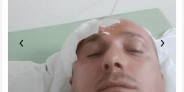 Тони не бара чудо, бара шанса: Потребна е итна поддршка за операција на мозок закажана за 29-ти овој месец
