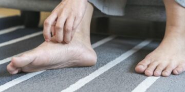 Ви отекуваат стапалата и зглобовите? Еве кога станува збор за безопасна појава, а кога треба да се побара лекарска помош