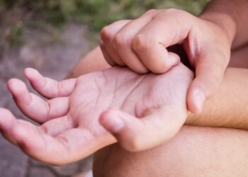 Што значи кога ве чеша дланката? Народот вели „пари“, медицината има сосема друго објаснување