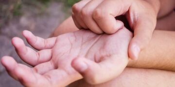 Што значи кога ве чеша дланката? Народот вели „пари“, медицината има сосема друго објаснување